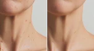 Appareil de Beauté à LED  pour Cou avec 7 Couleurs de Soins de la Peau